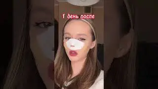 Я решила сделать пластическую операцию