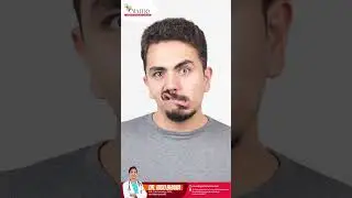 What is a mini-stroke? | Dr Indu Bhana | Neurology Specialist
