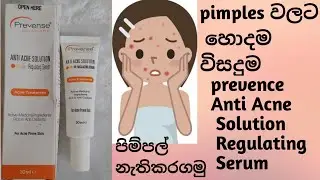 prevense Anti Acne Solution Regulating Serum පිම්පල් වලට විසදුම #pimplescare