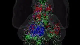 Zebrafish brain lights up during scan