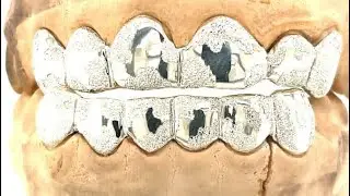 6 top 6 bottom silver diamond dust grillz near seattle wa.