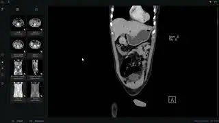 Pediatric Oral/viva cases 8