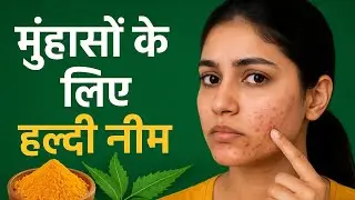 Haldi Neem Ka Desi Nuskha | Pimples, Acne & Daag Hataye Naturally | Glowing Skin Herbal Face Pack