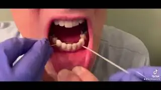 Tufted Dental Floss