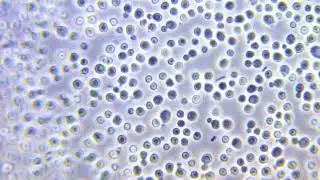 Candida albicans under phase contrast microscope
