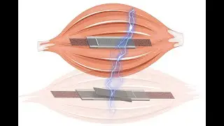Self sensing electric artificial muscles