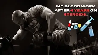 MY BLOOD WORK AFTER 4 YEARS ON STEROIDS | RAW BACK & BICEPS SESSION