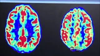 Coffee Brain health Tea Caffeine Drinks Education Science Health Fitness Wellness Food Knowledge 🧠 👀