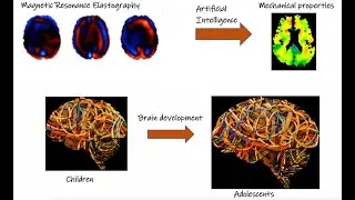 BREAKOUT 1 - Digitalized Medicine: Characterization of the mechanical tissue properties of the brain