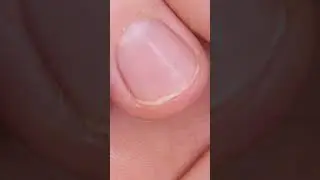 Преимущества коллагеновых добавок