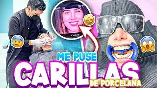 Me PUSE CARILLAS | Se me CAYERON los DIENTES | Los Molina