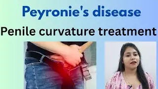 Peyronie's disease (penile curvature) treatment! Peyronie's disease symptoms,cause & best  medicines
