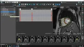 MR explained: Function Analysis