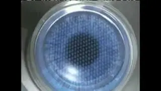 Funcionamiento del l&aacute;ser Femtosegundo Intralase