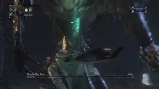 Bloodborne sucks