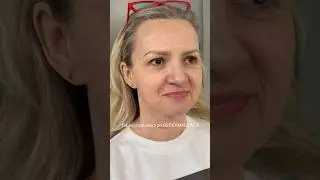 Jak wygląda sk&oacute;ra bezpośrednio po zabiegu redermalizacji 🤔