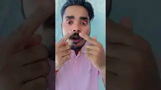 💯West Eye magic trick✅ #magic #shorts #eyes