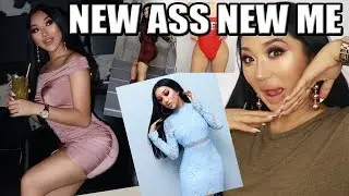 BRAZILIAN BUTTLIFT Q&A || BBL SURGERY