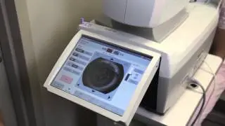 Zeiss iProfiler
