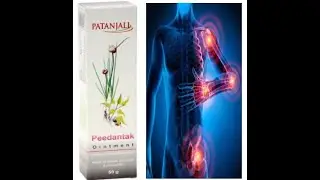 Natural remedies for body pain | Natural remedies for back pain and inflammation