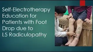 #1 Self-Electrotherapy Education for Patients with Foot Drop due to L5 Radiculopathy
