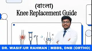 Knee Replacement Explained [বাংলা] | Types, Benefits, Risks & Recovery Guide for Patients