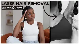 Getting Laser Hair Removal On My Dark Skin 😰 | Cost, Safety, Full Brazilian, Ingrown Hairs