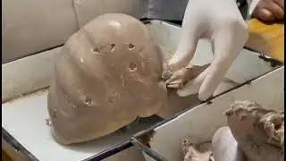 Gross anatomy of liver - anatomical Position, ligaments, bare area | Liver Anatomy - Part 1