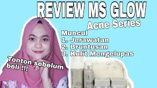 REVIEW JUJUR 2 BULAN PEMAKAIAN MS GLOW ACNE SERIES ( GLOWING PARAH) | Dhea Apriliani