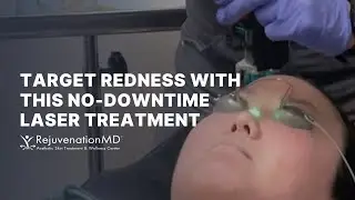 A No-Downtime Facial for Picture-Perfect Skin