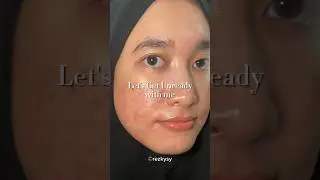 My first video as Noksibcho Ambassador #5thAmb1st #shorts #kbeauty #acnecare