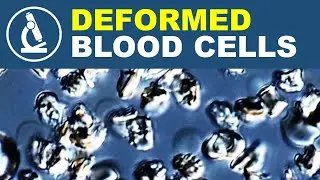 Why SALT causes cells to shrink | Blood under the microscope