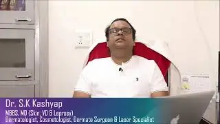 Birthmark Removal (Nevus of OTA) Laser Treatment - By Dr. S.K Kashyap (Dermatologist), South Delhi.