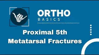 Ortho Basics: Proximal 5th Metatarsal Fractures