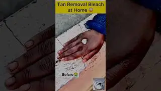 Tan Removal Bleach at home😱 #tanremovalbleachathe #tanbleach #tanremovel #darkhandtreatment #shorts