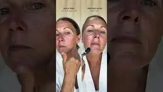 Peeling Mask vs Daily Peel