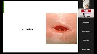 TIPS-ECHO Season 181 FCPN 26:Session 09|Ostomy Care|Br Sajan vs