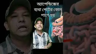 appendix ||appendicitis ||অ্যাপেন্ডিক্সের ব্যথা কোন পাশে হয়
