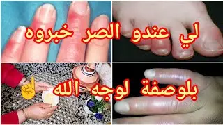 #اقوى كريمة🥣 لصر اليدين ✋️والرجلين🦶 تهنيكم من عداب البرد والشتا🥶#غير من الكوزينة ونتي درتيها#