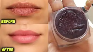 Baby Soft Pink Lips Beetroot Lip Balm: Get Pink Lips NATURALLY! In 7 Days
