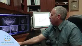 3D Scanning : Dental Implants