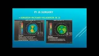 James Salz - Topography-Guided PRK for Irregular Astigmatism in my Left Eye