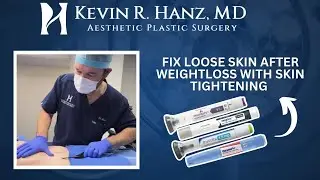 Fix LOOSE SKIN from Ozempic with SKIN TIGHTENING #ozempicweightloss #skintightening