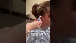 BTE hearing aid for this patient with profound hearing loss! #rochesterny #audiologist #rochester