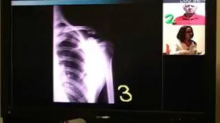 Pointmaker draws over far end video.