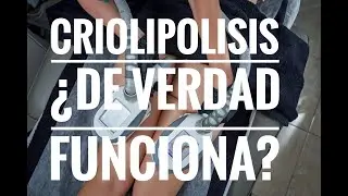 Criolipolisis ¿DE VERDAD FUNCIONA?