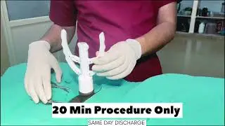Live ZSR Circumcision Surgery in Jaipur | Dr. Deepesh Goyal | Painless & Quick Procedure Explained