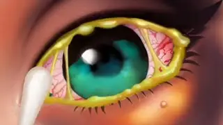 Asmr Face Treatment Animation | #asmrsound #asmrviral #asmr #treanding #cleaning #pimple 
