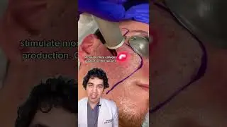 This Acne Scar Combination Treatment is HIGHLY Effective 🔥