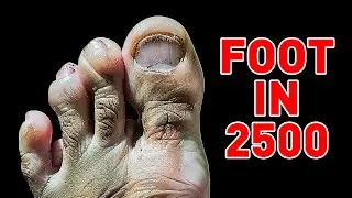 Humans Will Have FOUR TOES on Their Feet in the Future: Fascinating Body Facts